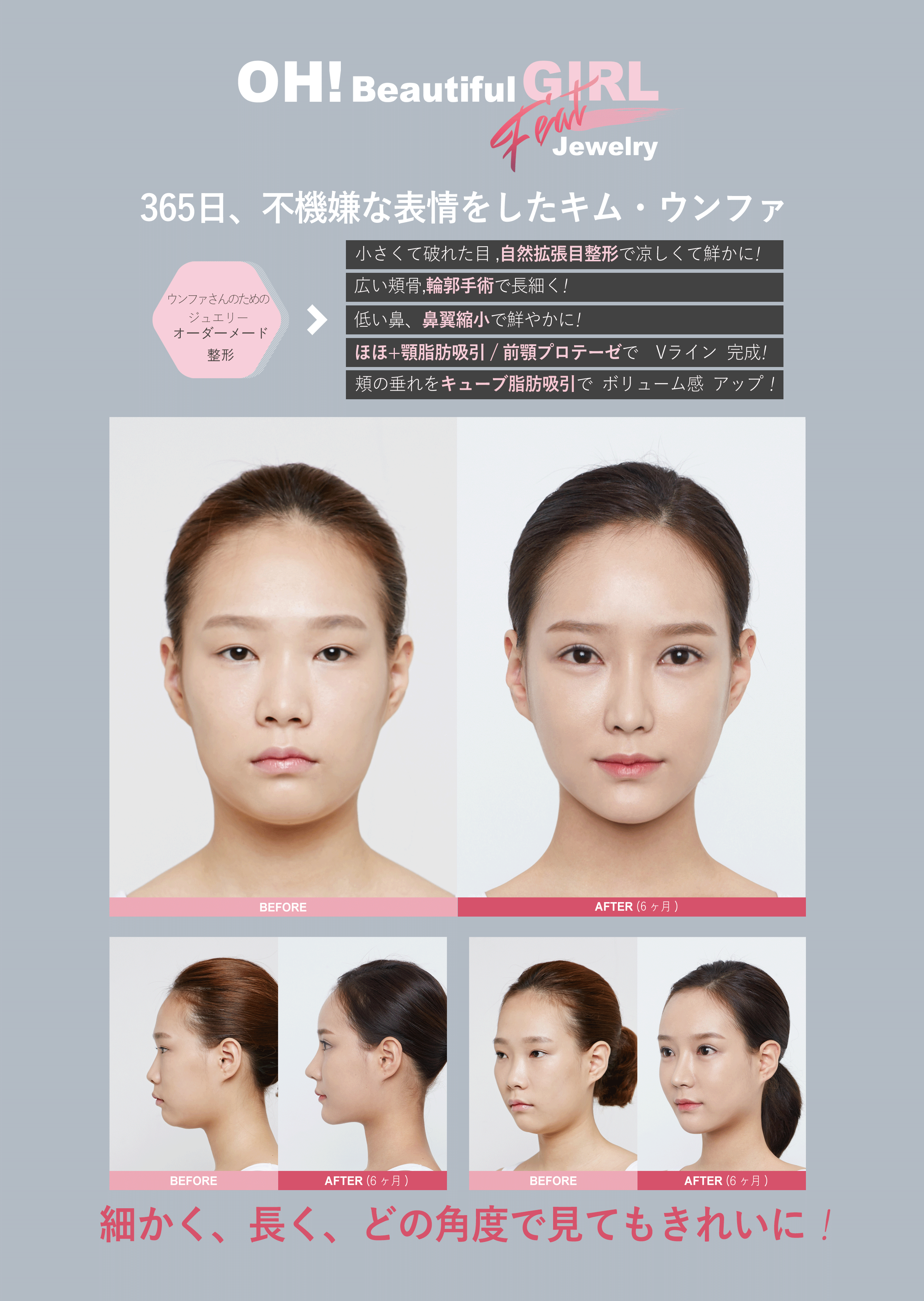 ジュエリー美容外科 目の整形 キムウンハ2 ジュエリー美容外科