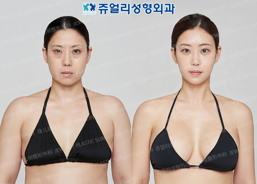상반신1