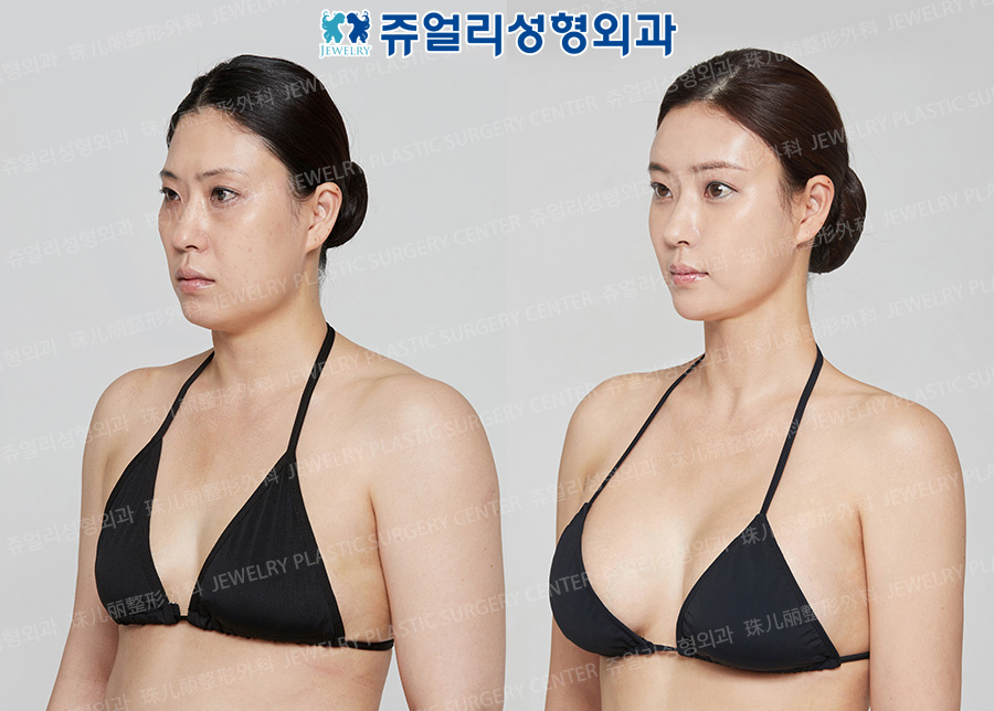 상반신2