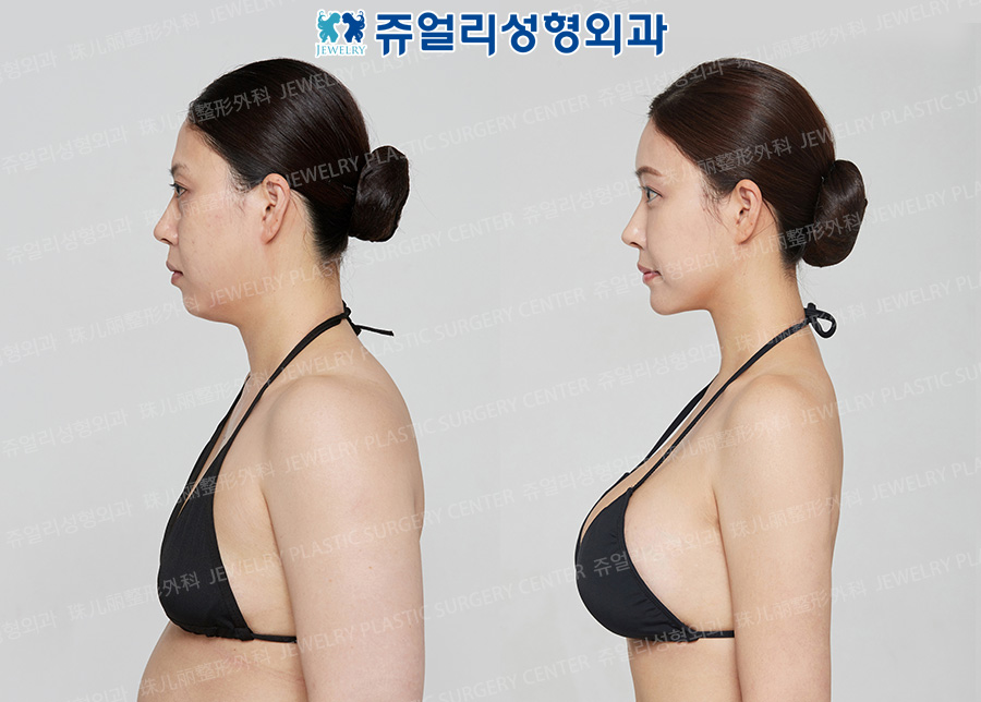 상반신3