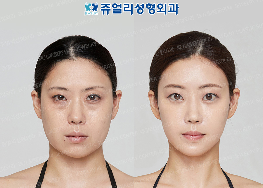 얼굴1