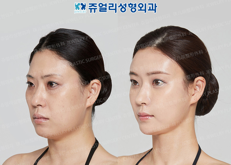 얼굴2