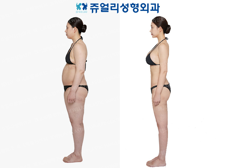 전신3-3