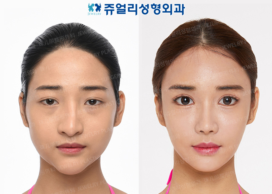 その他の術前・術後写真 1