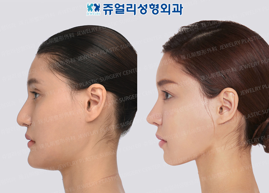 その他の術前・術後写真 3