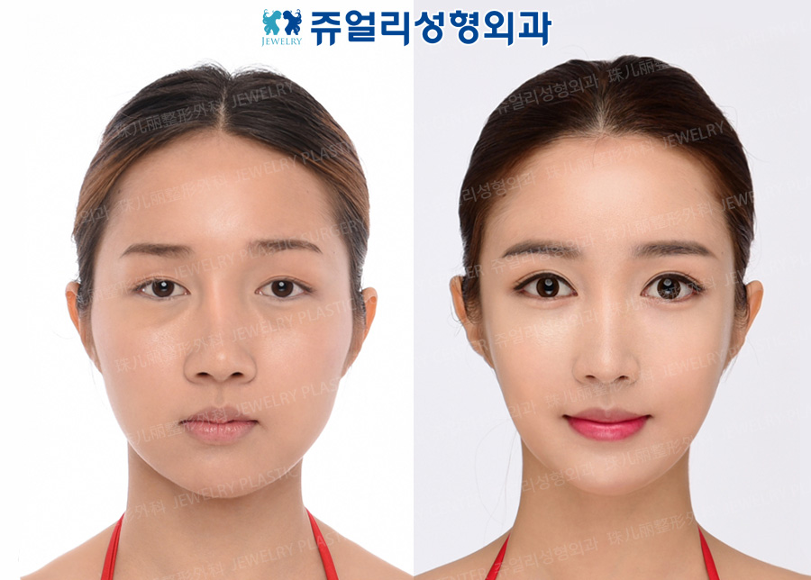 その他の術前・術後写真 1