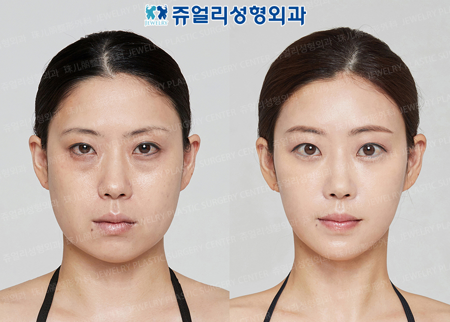 その他の術前・術後写真 1