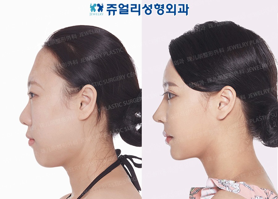 その他の術前・術後写真 3
