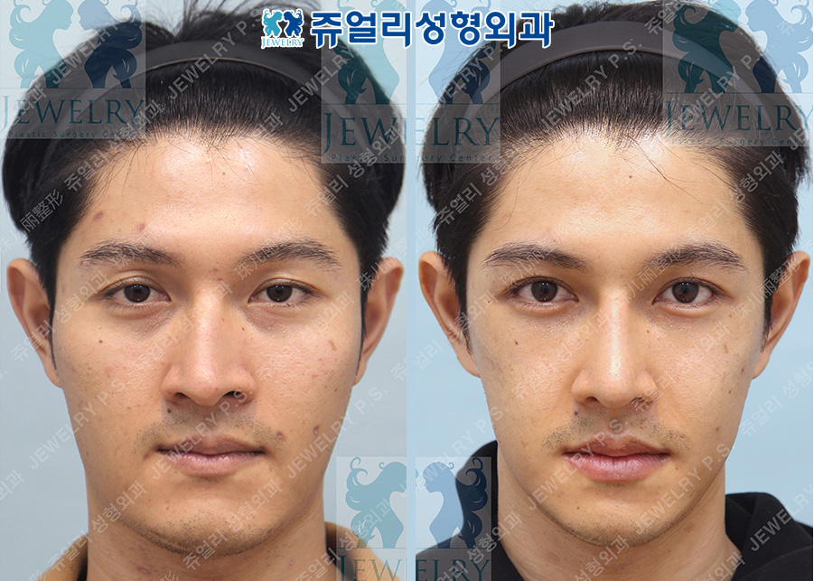 その他の術前・術後写真 1