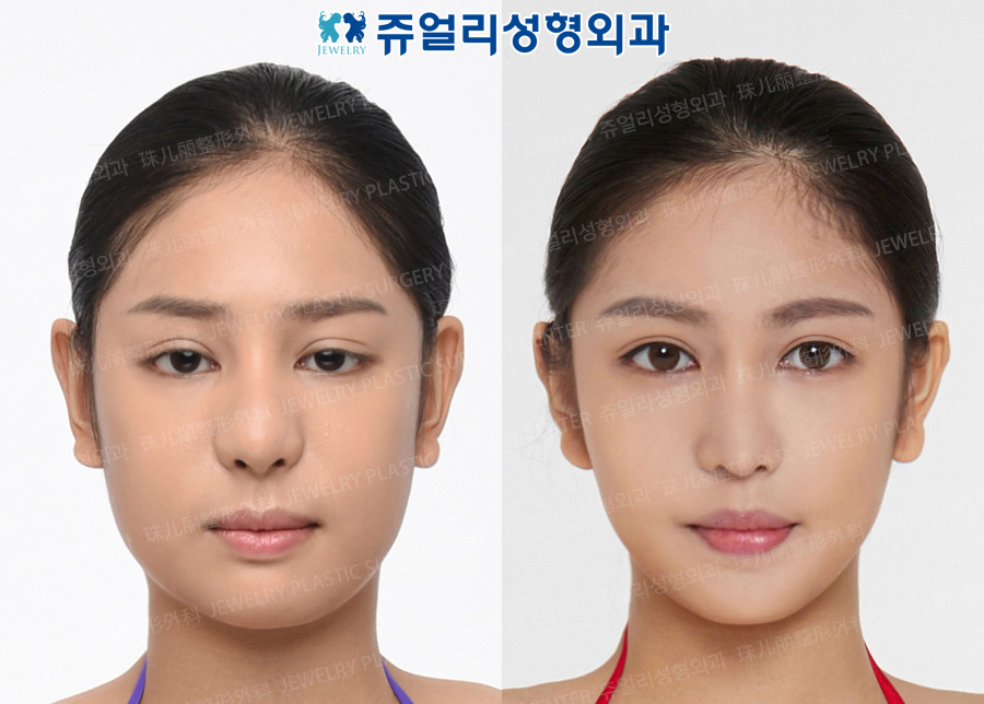 その他の術前・術後写真 1