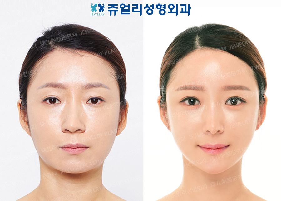 その他の術前・術後写真