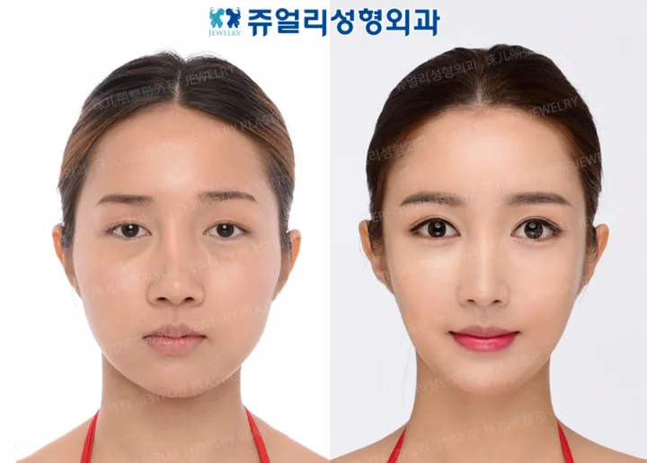 その他の術前・術後写真 1