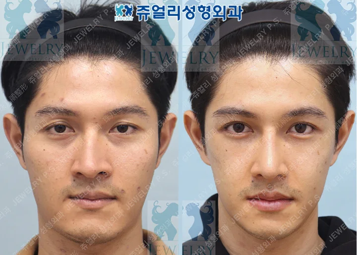 その他の術前・術後写真 1