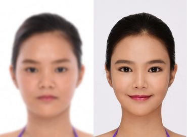 before_after_eye9