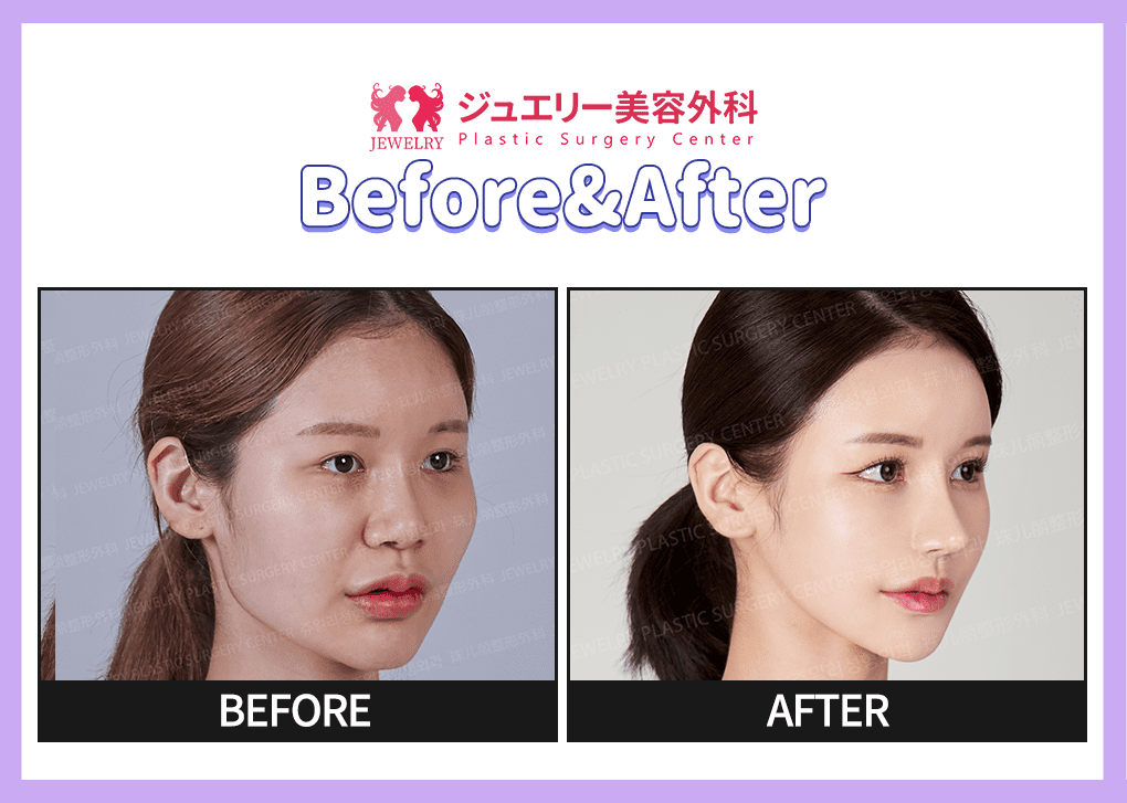 랜딩페이지 전후사진 02