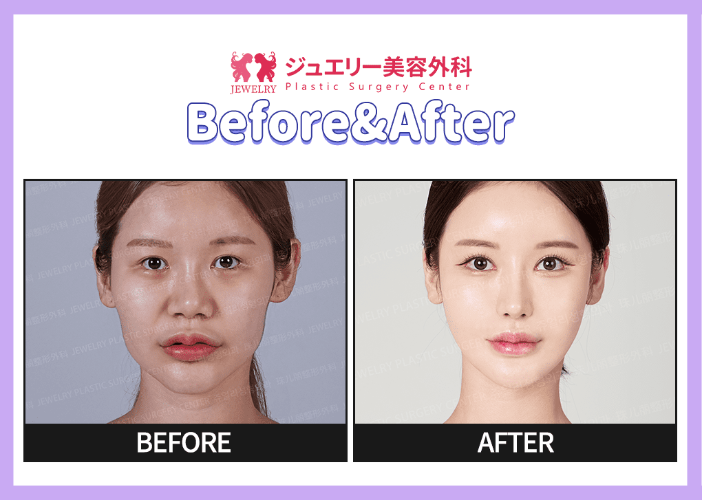 랜딩페이지 전후사진 03