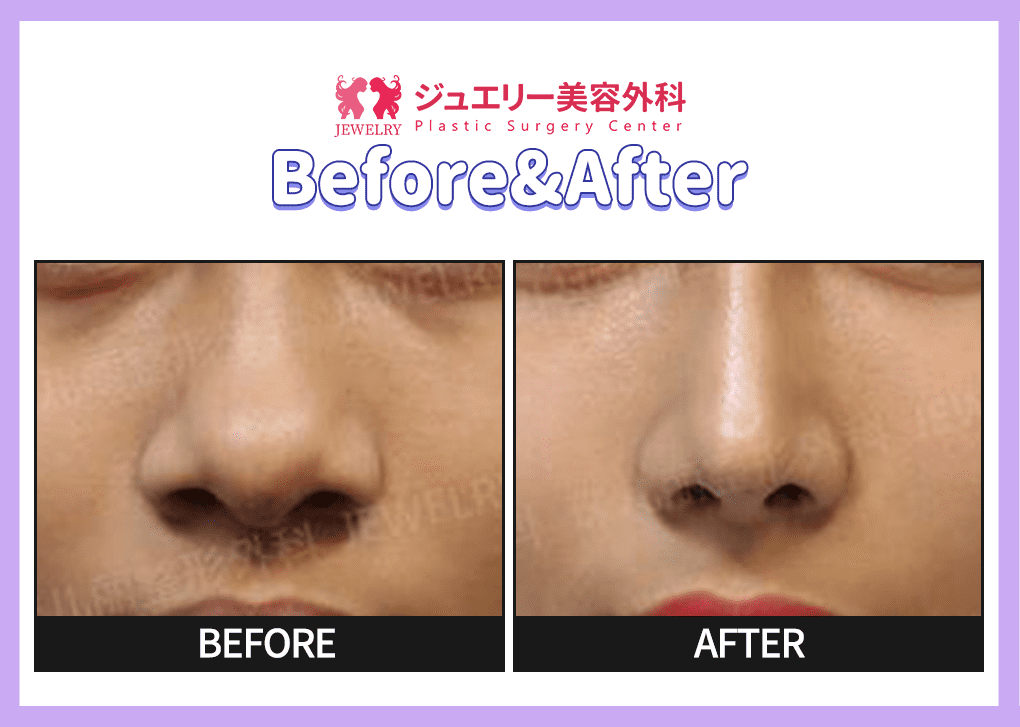 랜딩페이지 전후사진 코