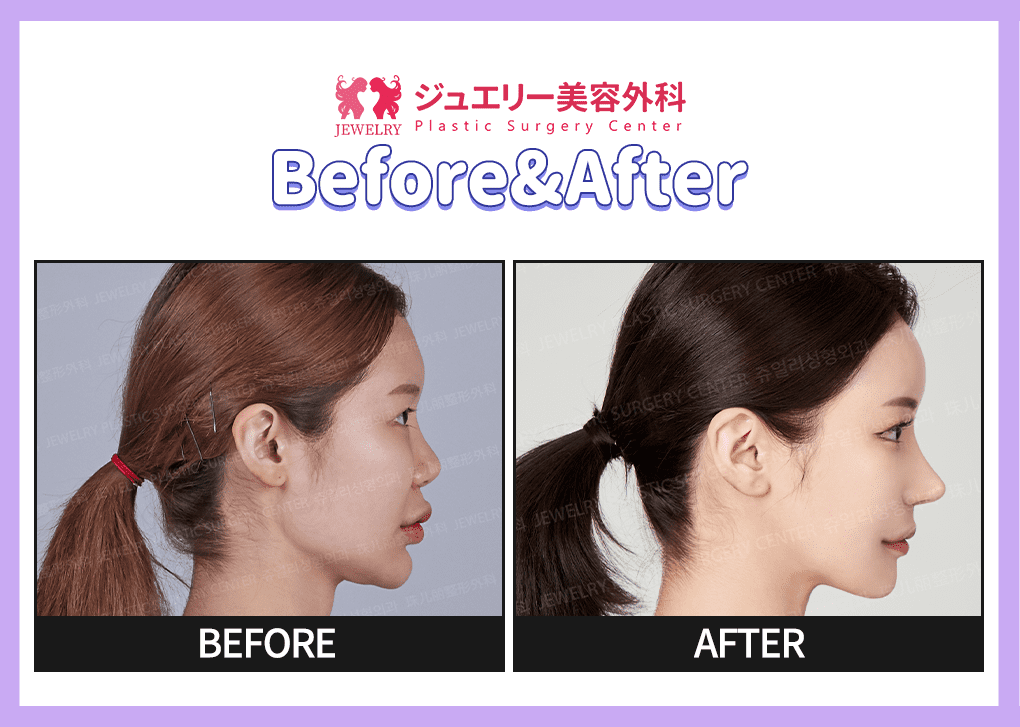 랜딩페이지 전후사진