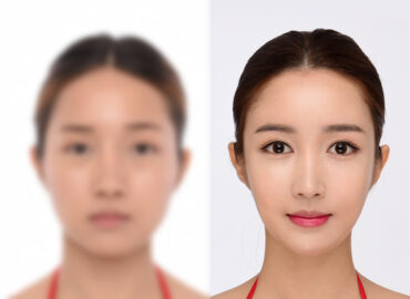 before_after_img1