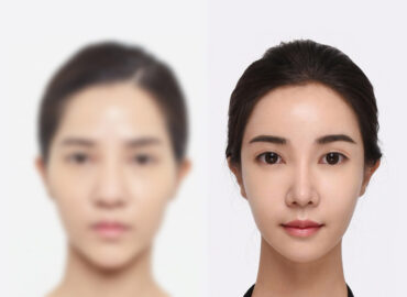 before_after_img10