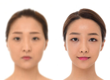 before_after_img11