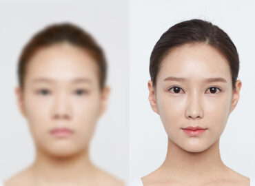 before_after_img12