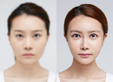 before_after_img16