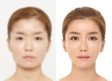 before_after_img17