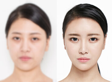 before_after_img2