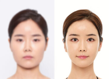 before_after_img4