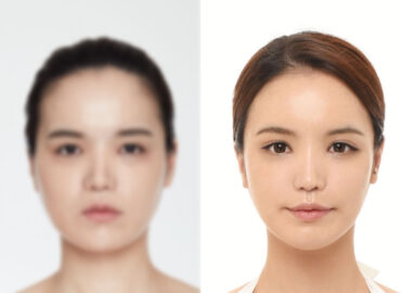 before_after_img9